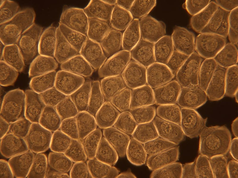 Human gut cells seen under a microscope